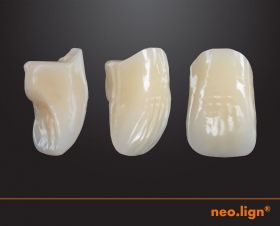 neo.lign upper anterior