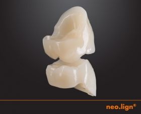 neo.lign upper/lower posterior G2